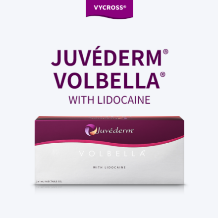 Juvederm Volbella with Lidocaine